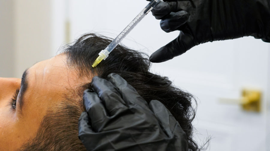How Platelet-Rich Plasma (PRP) Can Stimulate Hair Growth