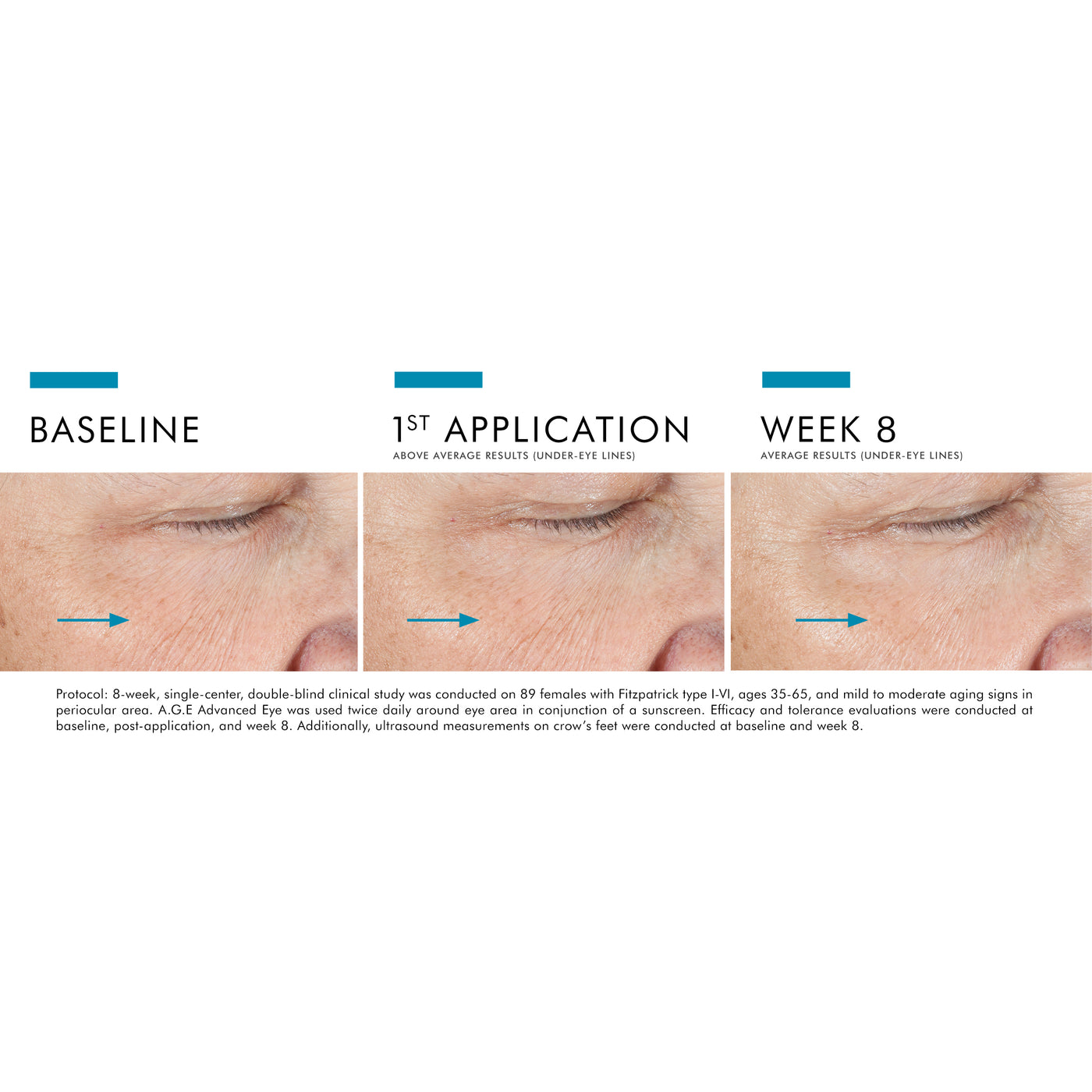 Advanced Eye Factor SkinCeuticals A.G.E. Advanced Eye – MD Skin Lab Canada