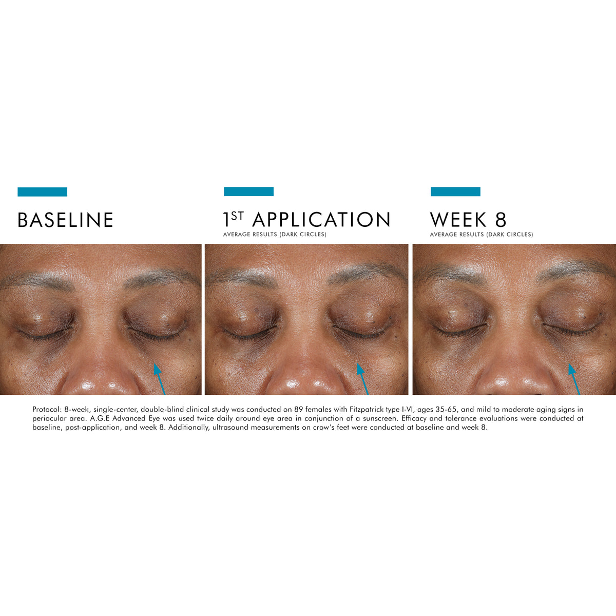 Advanced Eye SkinCeuticals A.G.E. Advanced Eye – MD Skin Lab Canada