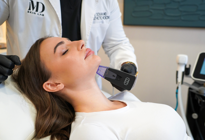 Morpheus8 RF Microneedling Package at MD Skin Lab