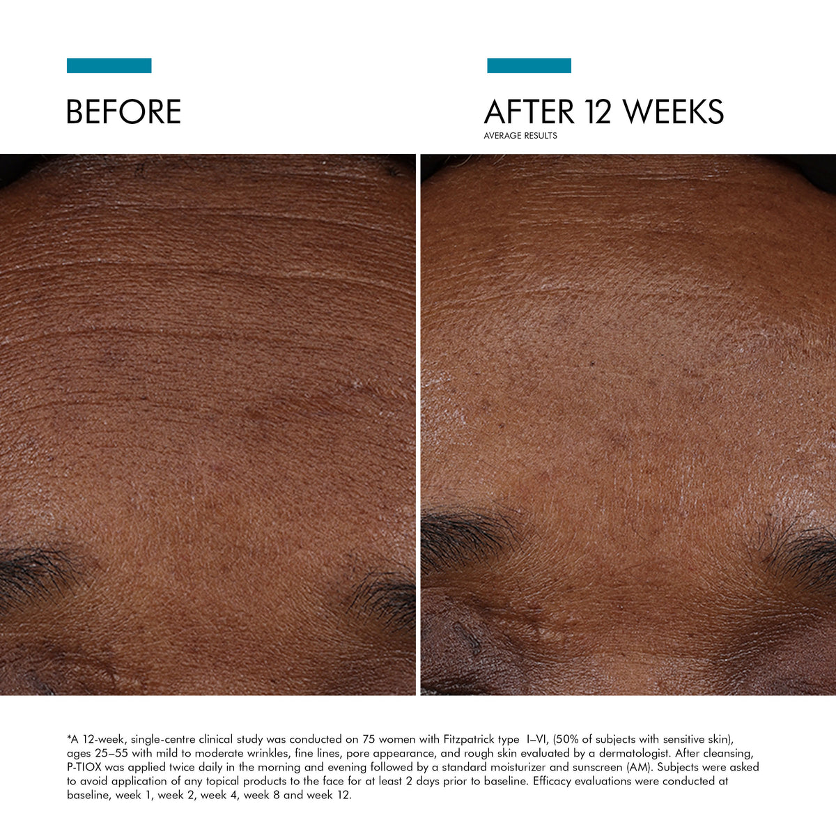 SkinCeuticals P-TIOX Anti-Wrinkle Serum