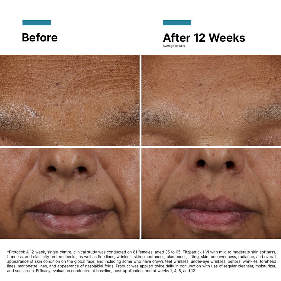 SkinCeuticals HA Intensifier Multi-Glycan