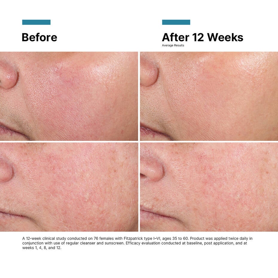 Advanced RGN-6 (Next-Level Skin Regeneration Cream)