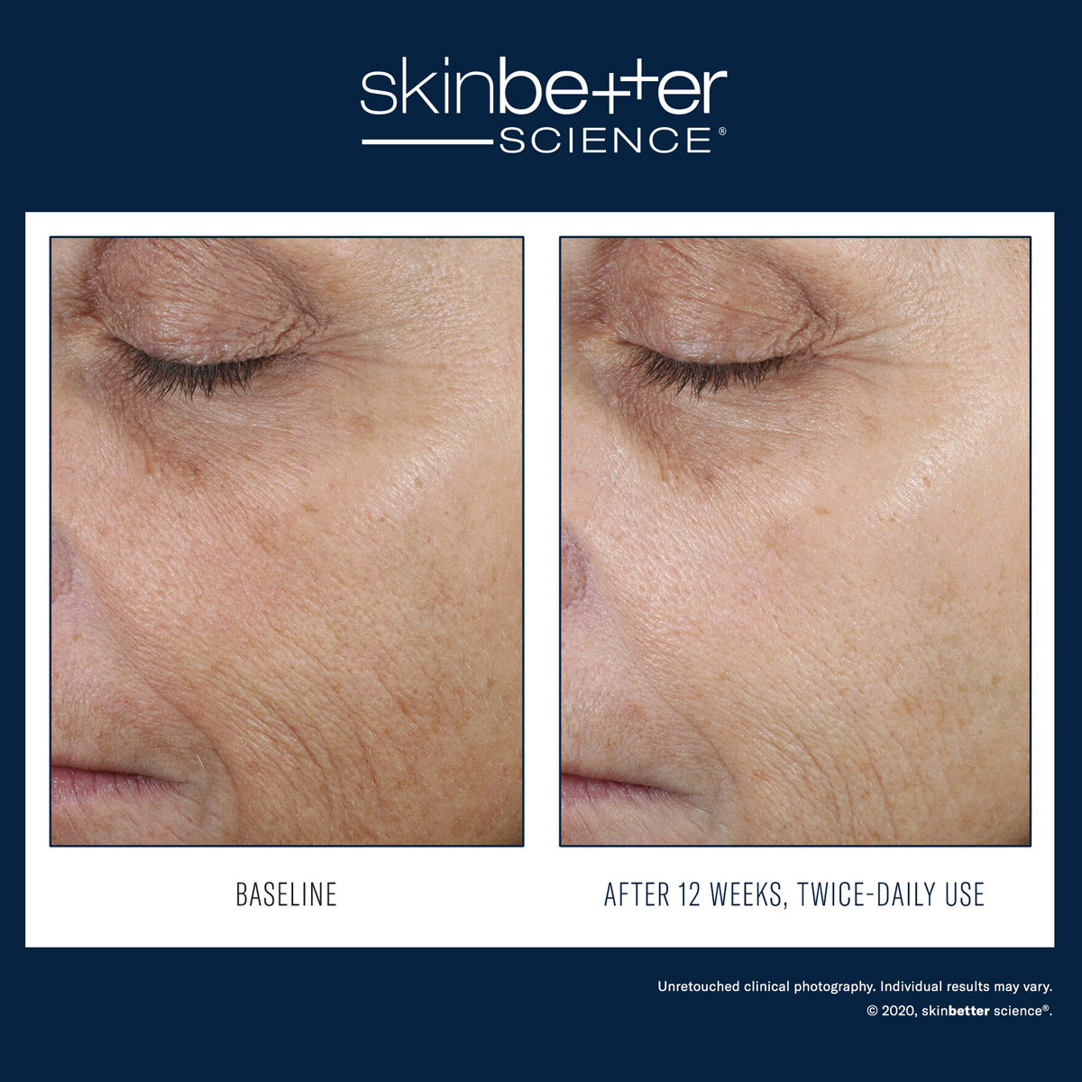 SkinBetter Science Even Tone Correcting Serum